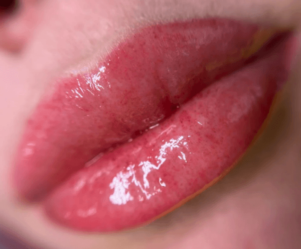 How Long Does Lip Plumper Last