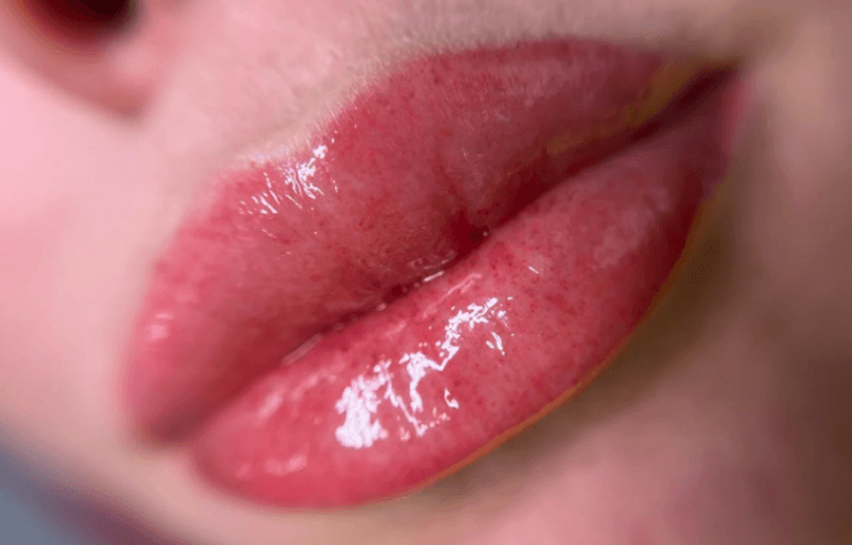 How Long Does Lip Plumper Last